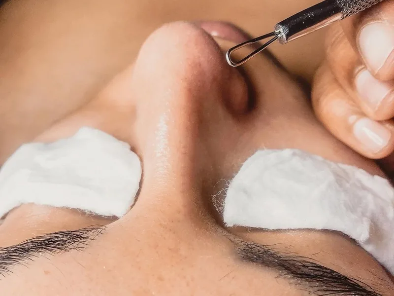 Limpieza Facial de Extracción