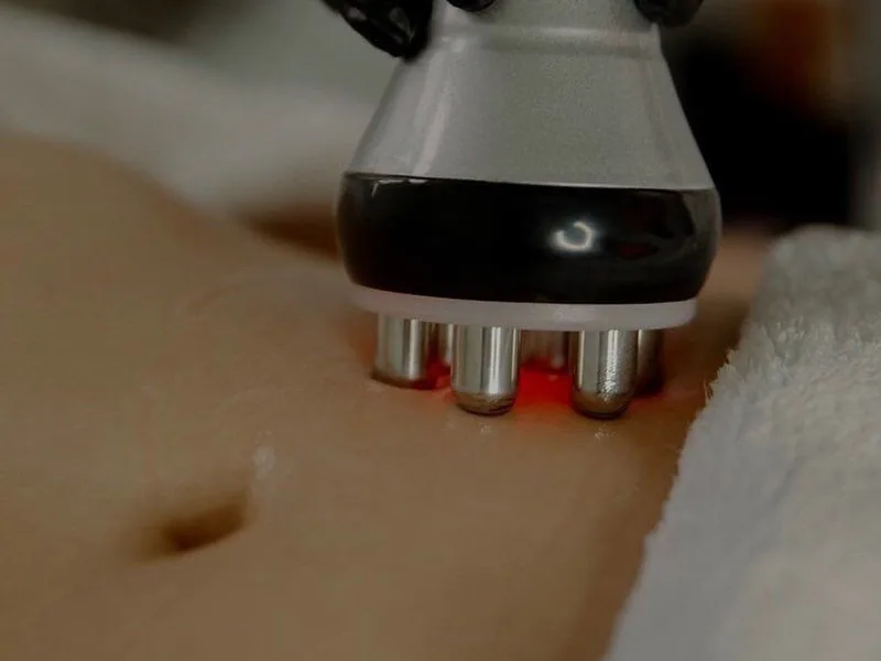 Terapia Pre Operatoria para una Cirugía Plástica